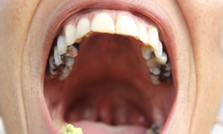 Suavinex SX PRO 0-6 m Birdies cumlík 2 ks - zelený