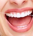 Ako vybrať správnu zubnú niť