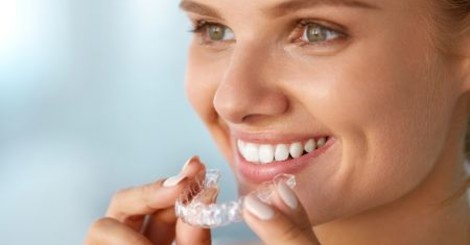 Ako vybrať vhodnú sadu na bielenie zubov?