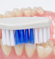Druhy vykladacích zubných náhrad