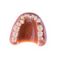 TePe Comunicator model problematických zubov