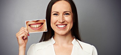 Dentálna hygiena: estetické výkony dentálnej hygieničky