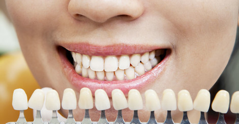 Čo všetko ovplyvňuje odtieň zubov?