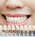 Čo všetko ovplyvňuje odtieň zubov?