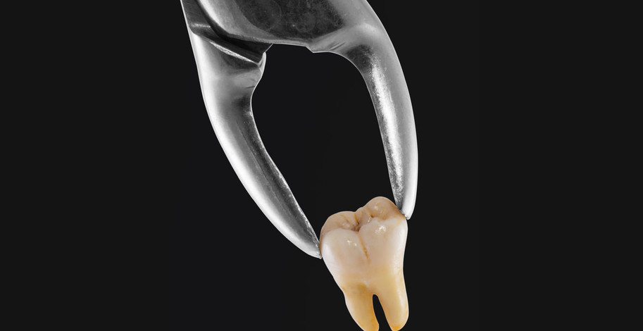Trhanie zubov