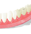 3 typy bielenia zubov