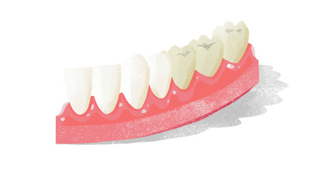 3 typy bielenia zubov - ako šetrne získať krásny úsmev a sebaistú povahu?