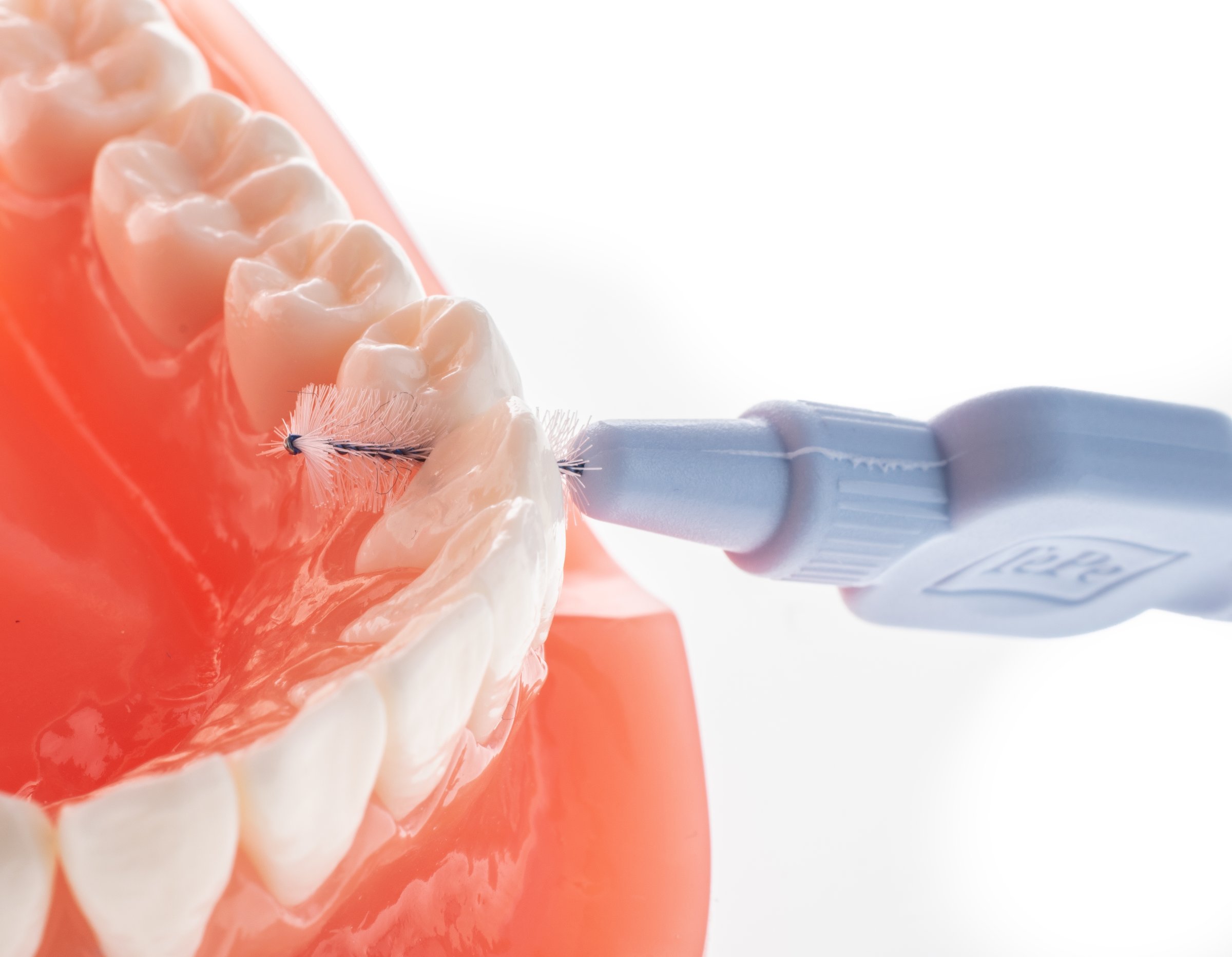 TePe Extra Soft 0,60 medzizubné kefky modré 8 ks