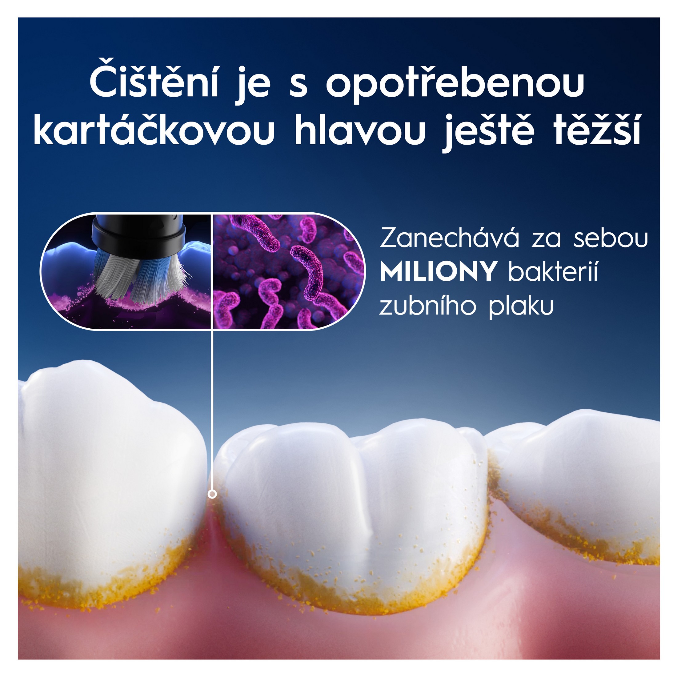 Oral-B iO Gentle Care Black náhradné hlavice 2 ks