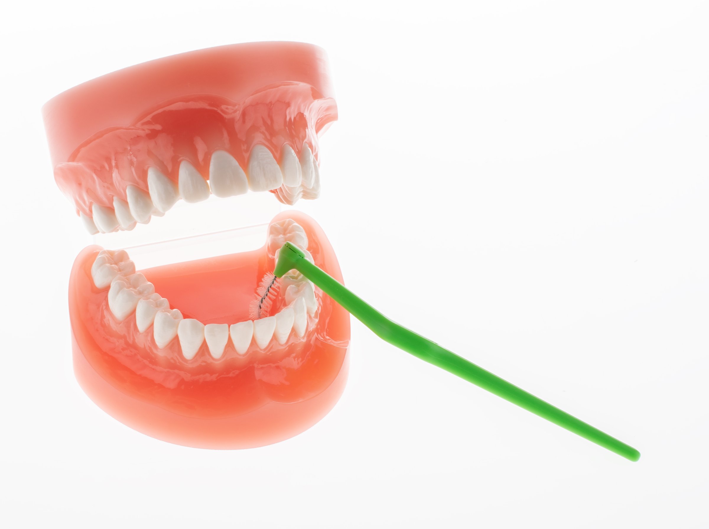 TePe Multipack ANGLE 0,80 medzizubné kefky zelené 25 ks