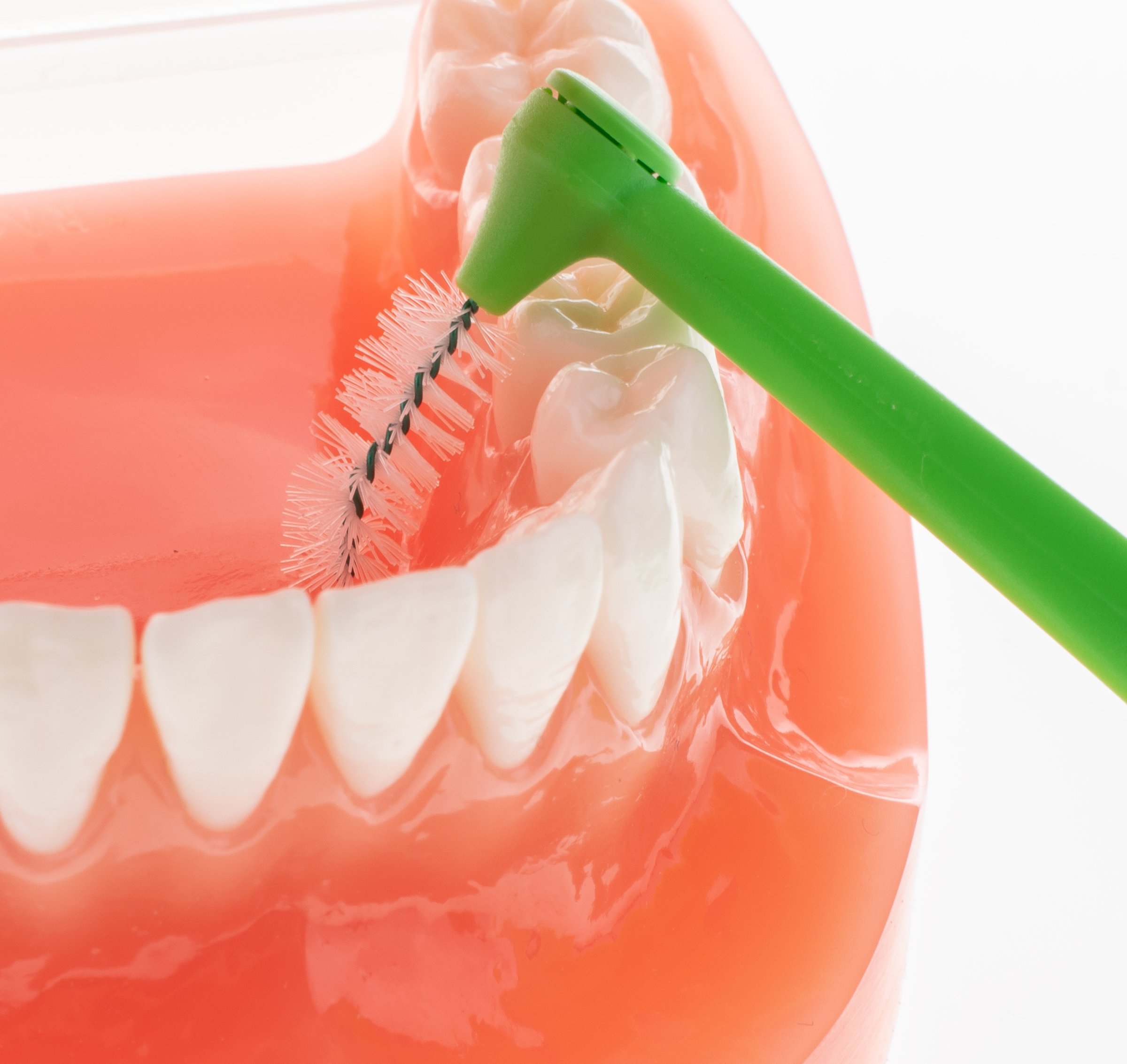 TePe Multipack ANGLE 0,80 medzizubné kefky zelené 25 ks