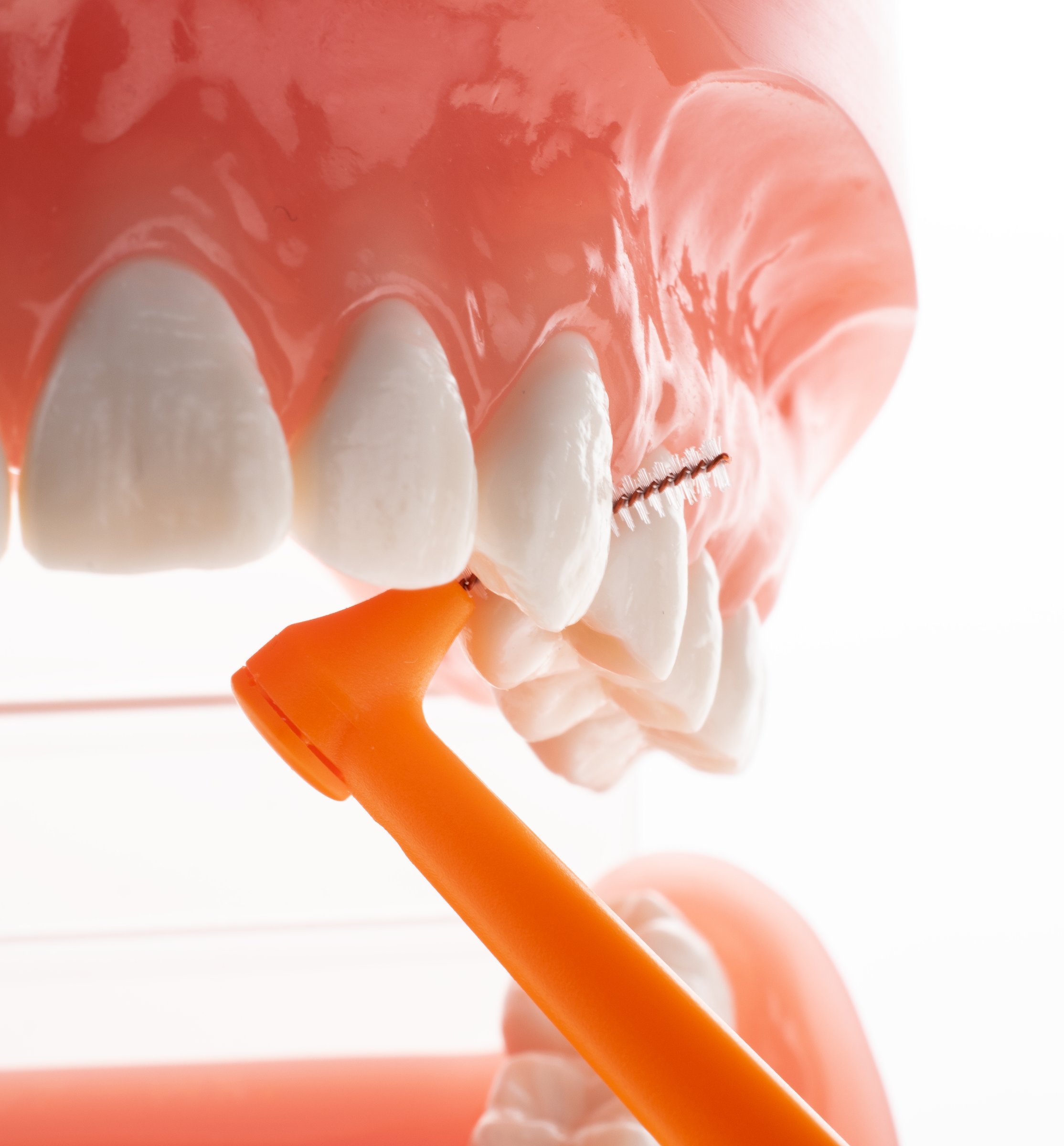 TePe Multipack ANGLE 0,45 medzizubné kefky oranžové 25 ks