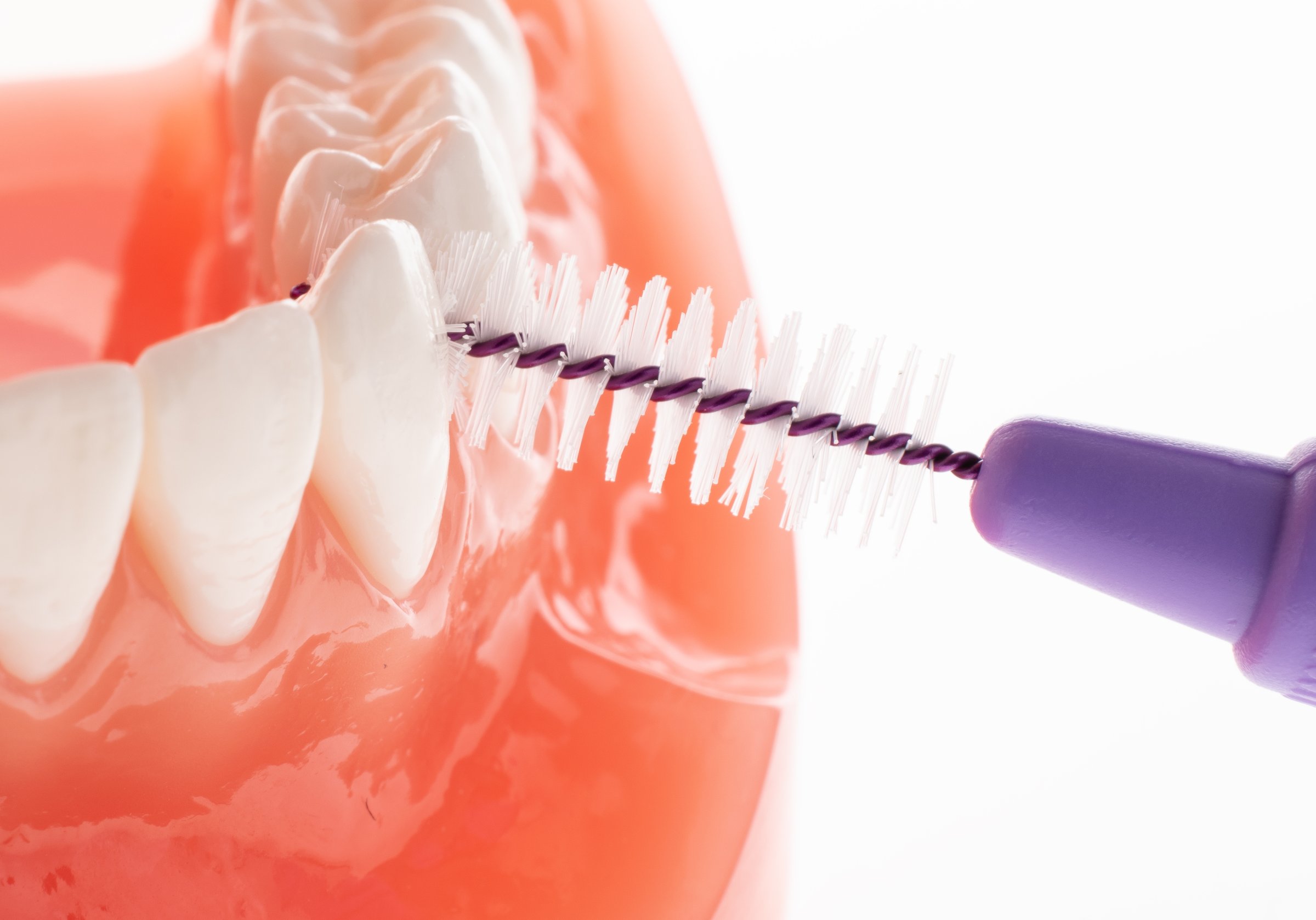 TePe 1,10 medzizubné kefky fialové 25 ks