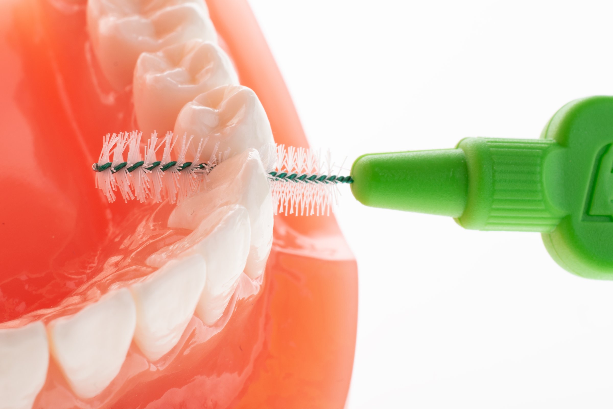 TePe 0,80 medzizubné kefky zelené 25 ks