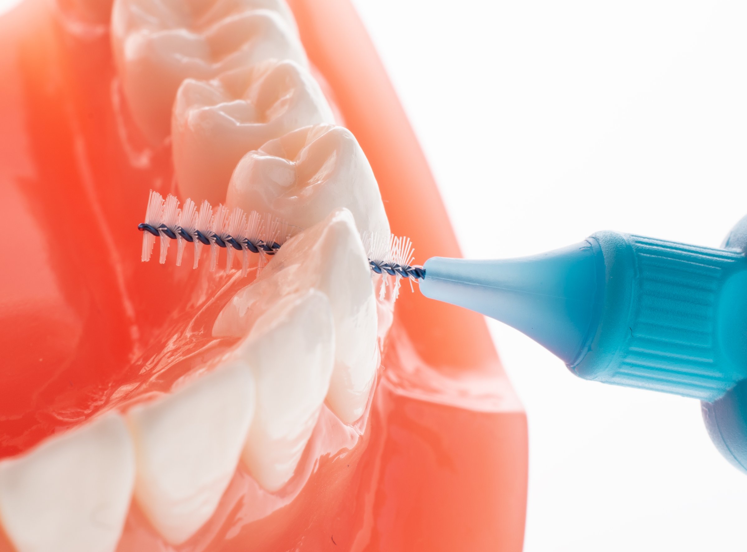 TePe 0,60 medzizubné kefky modré 25 ks